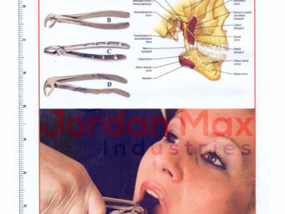 EXTRACTING FORCEPS